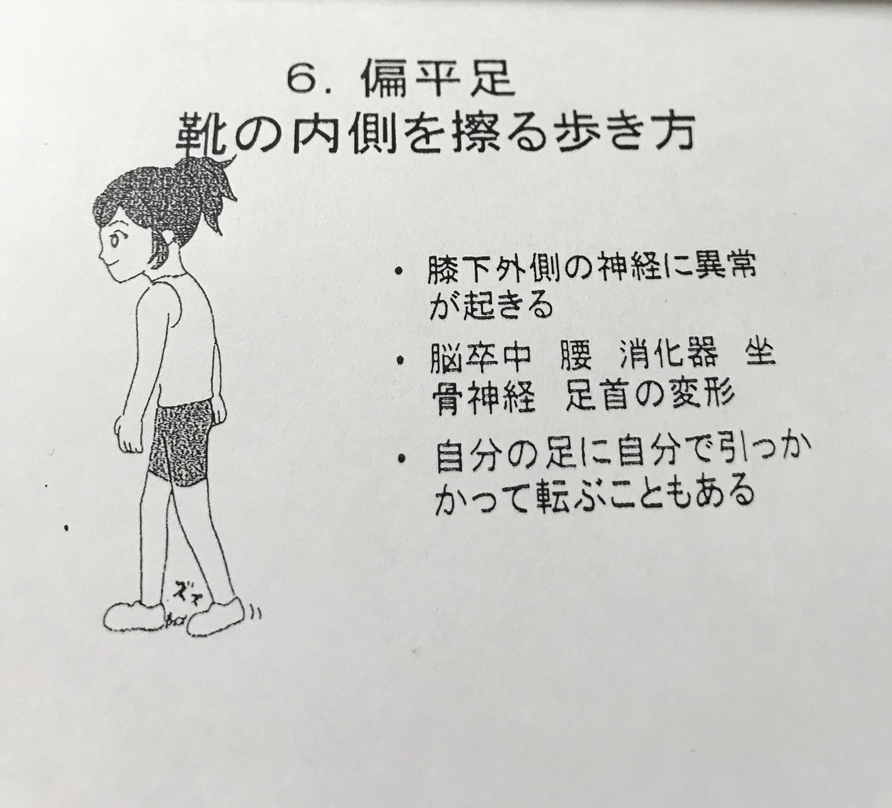 歩き方に診る健康『扁平足、靴の内側を擦って歩く歩き方』