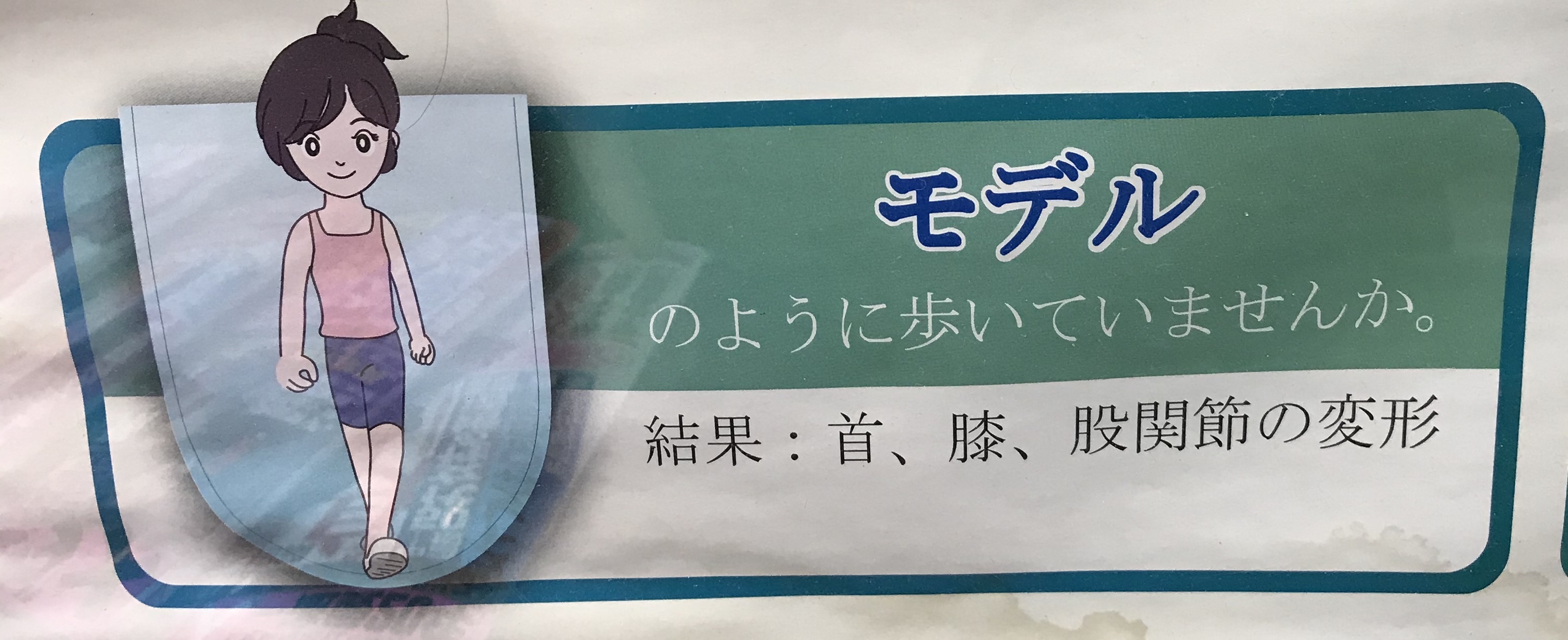 歩き方に診る健康『ハサミ歩き、モデル歩き、内股歩き』