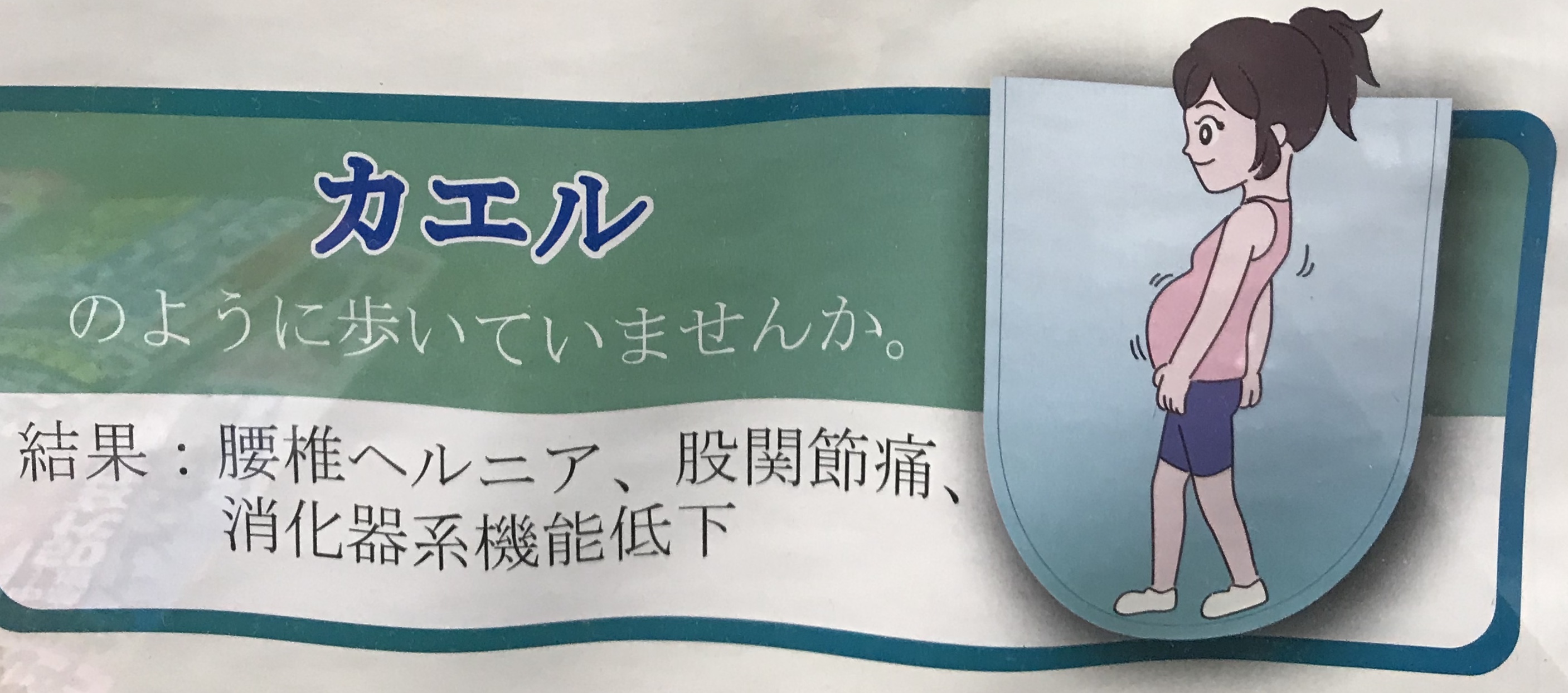 歩き方に診る健康『カエル歩き、妊産婦歩き』